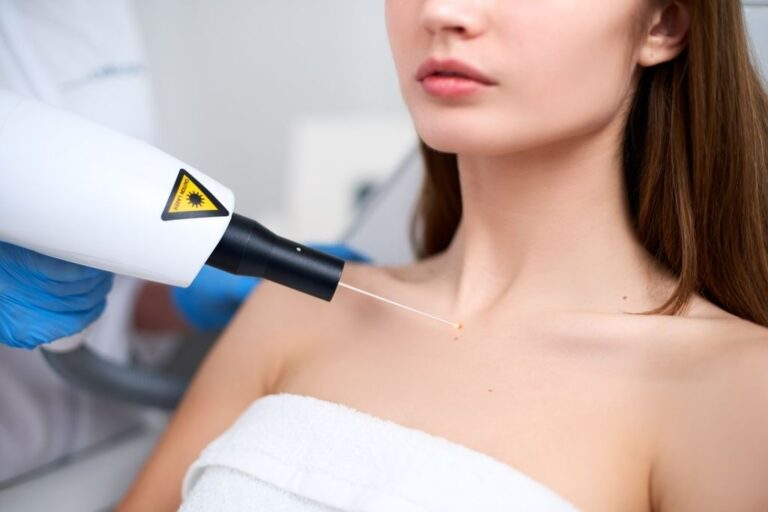 Mole Removal, healthy teen girls