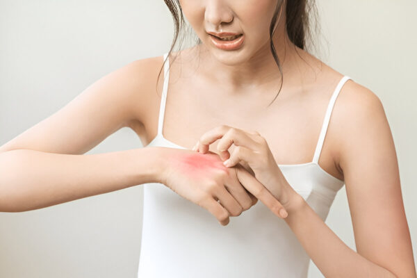 Can eczema cream soothe itchy skin? Can eczema cream soothe itchy skin